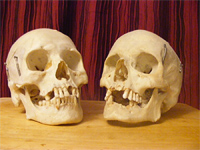 Skulls